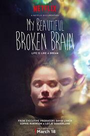 我美丽易碎的大脑 My Beautiful Broken Brain (2014)